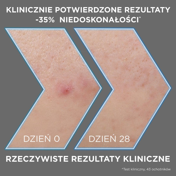 Garnier Pure Active serum przeciw niedoskonałościom AHA + BHA + Węgiel 30ml