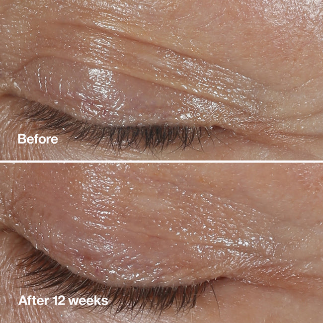 Clinique Smart Clinical Repair™ Wrinkle Correcting Eye Cream korygujący krem przeciwzmarszczkowy pod oczy 30ml