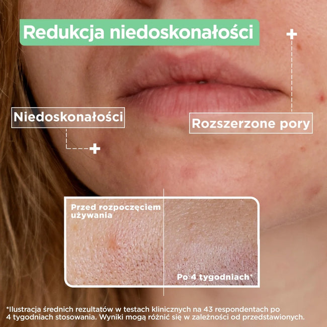MIXA Lab serum przeciw niedoskonałościom Kwas Salicylowy + Niacynamid 30ml