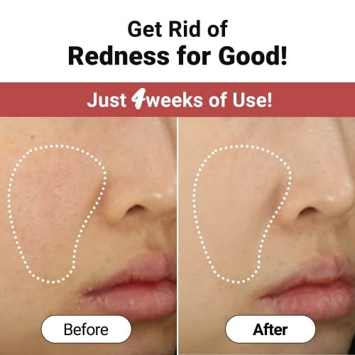 Troubless Clear Redmark Soothing Facial Sheet Mask łagodząca maska w płachcie 25ml