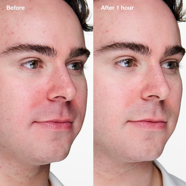 Clinique Anti-Blemish Solutions Clinical™ Advanced Clearing Gel żel przeciw niedoskonałościom skóry 20ml