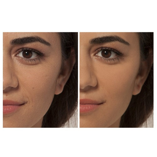 L'Oreal Paris True Match All in One korektor