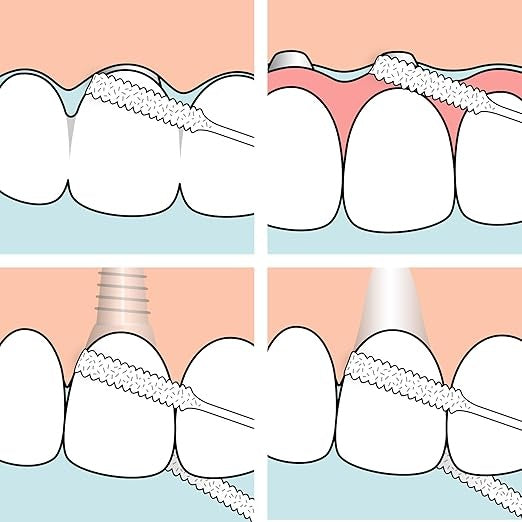 TePe Bridge & Implant Floss nić dentystyczna do mostów i implantów 30szt